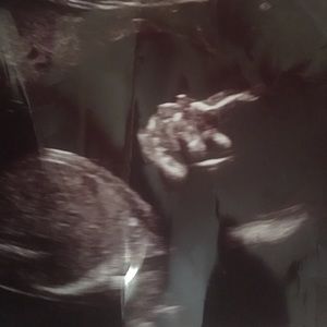 Meet your Posher, Omaralys